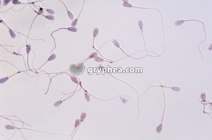 Spermatozoïdes de Taureau x200 - gryphea.com